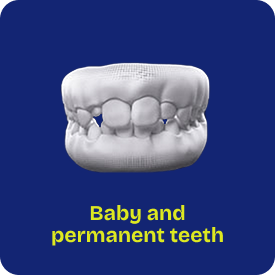 Invisalign First for children with baby and permanent teeth (mixed dentition) at International Dental Care Hyderabad – early treatment age 6–10