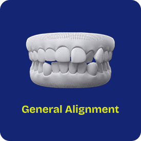 general alignment of any teeth using invisalign aligners
